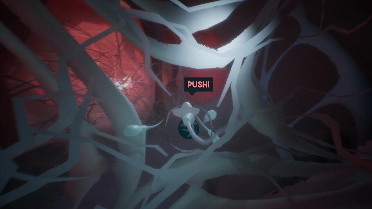 Capture de Become